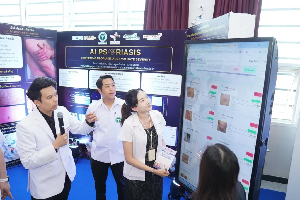 AI Psoriasis Screening Tool Enhances Healthcare Access